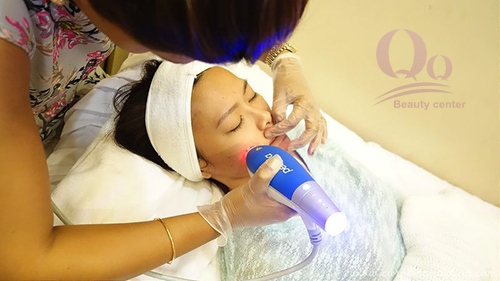 Công nghệ trị mụn hiệu quả nhất Cong nghe tri mun hieu qua nhat